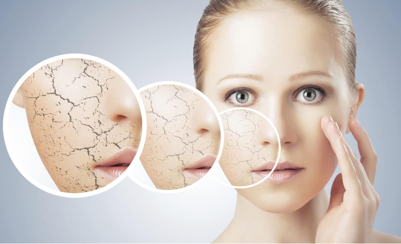 От андрогенов до дофамина: как гормоны влияют на состояние кожи