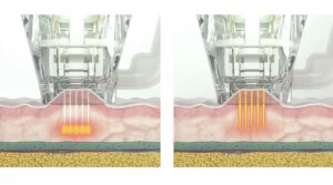 ЭКСКЛЮЗИВНОЕ ПРЕДЛОЖЕНИЕ МЕСЯЦА!